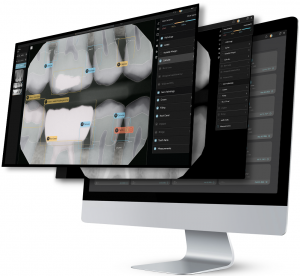 Pearl Second Opinion®