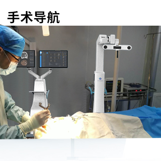 艾目易aimooe手术导航机器人整体解决方案_中国AGV网(www.chinaagv.com) 艾目易aimooe手术导航机器人整体解决方案_中国AGV网(www.chinaagv.com)